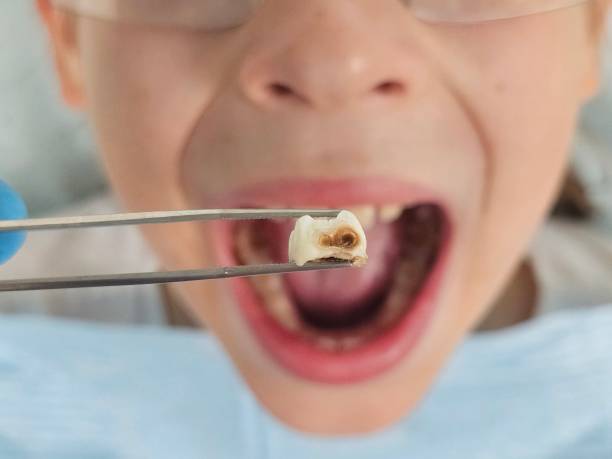 Best Emergency Root Canal Treatment in Mcguire Af, NJ